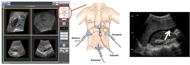 Portable 3D/4D ultrasound prototype hardware
